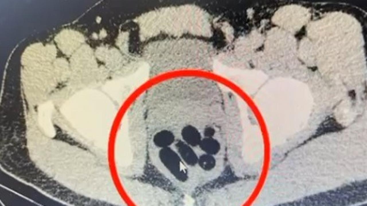 kayseride uyusturucu operasyonu midesinden cikan soke etti iRjipLi1.jpg